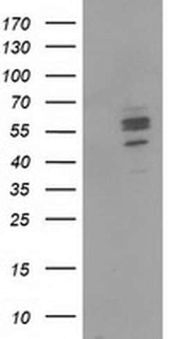 CNDP1 Monoclonal Antibody (OTI1A5), TrueMAB , OriGene:Antibodies:Primary