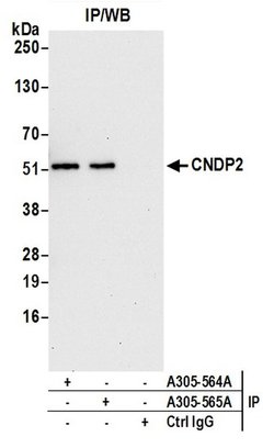 CNDP2 Rabbit anti-Human, Polyclonal, Bethyl Laboratories 100 &mu;l; Unlabeled:Antibodies,