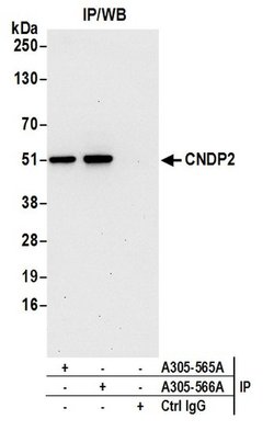 CNDP2 Rabbit anti-Human, Polyclonal, Bethyl Laboratories 100 &mu;L; Unconjugated:Antibodies,