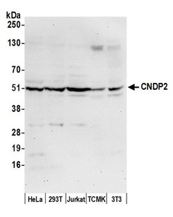 CNDP2 Polyclonal Antibody, Bethyl Laboratories 20 &mu;L | Buy Online | Bethyl Laboratories, Inc | Fisher Scientific