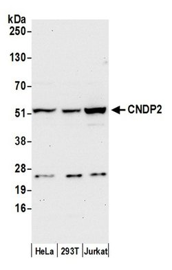 CNDP2 Rabbit anti-Human, Polyclonal, Bethyl Laboratories 100 &mu;L; Unconjugated:Antibodies,