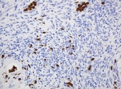 CNKSR3 Monoclonal Antibody (OTI1D7), TrueMAB , OriGene:Antibodies:Primary