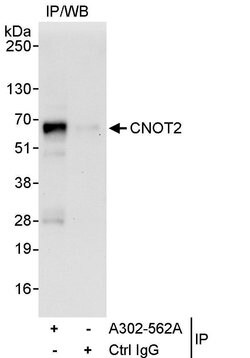 CNOT2 Rabbit anti-Human, Polyclonal, Bethyl Laboratories 100 &mu;l; Unlabeled:Antibodies,