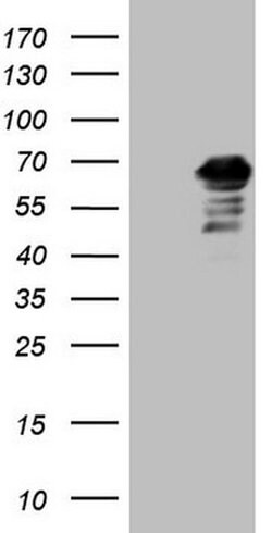 CNOT2 Monoclonal Antibody (OTI9B10), TrueMAB , OriGene 100 &mu;L; Unconjugated:Antibodies,