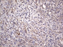 CNOT4 Monoclonal Antibody (OTI1F10), TrueMAB , OriGene 100 &mu;L; Unconjugated:Antibodies,