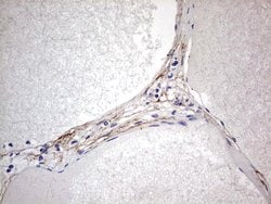 CNOT4 Monoclonal Antibody (OTI1F10), TrueMAB , OriGene 100 &mu;L; Unconjugated:Antibodies,