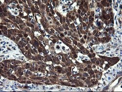 CNOT4 Mouse anti-Human, Clone: OTI1H2, lyophilized, TrueMAB 100 &mu;g;