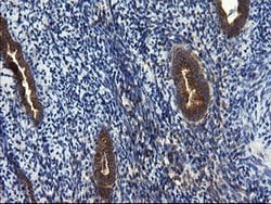 CNOT4 Mouse anti-Human, Clone: OTI1H2, lyophilized, TrueMAB 100 &mu;g;