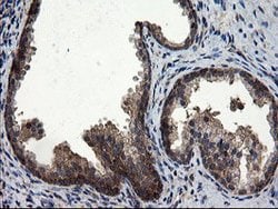 CNOT4 Mouse anti-Human, Clone: OTI1H2, lyophilized, TrueMAB 100 &mu;g;