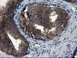 CNOT4 Mouse anti-Human, Clone: OTI1H2, lyophilized, TrueMAB 100 &mu;g;