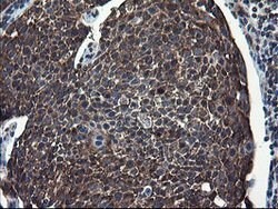 CNOT4 Mouse anti-Human, Clone: OTI1H2, lyophilized, TrueMAB 100 &mu;g;