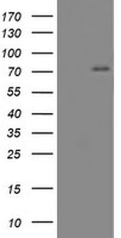 CNOT4 Monoclonal Antibody (OTI3A3), TrueMAB , OriGene 100 &mu;L | Buy Online | OriGene | Fisher Scientific