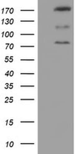 CNOT4 Monoclonal Antibody (OTI4B2), TrueMAB , OriGene:Antibodies:Primary