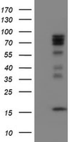 CNOT4 Monoclonal Antibody (OTI3B8), TrueMAB , OriGene:Antibodies:Primary