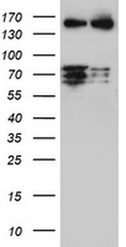 CNOT4 Monoclonal Antibody (OTI2F10), TrueMAB , OriGene:Antibodies:Primary