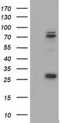 CNOT4 Monoclonal Antibody (OTI1G3), TrueMAB , OriGene 100 &mu;L; Unconjugated:Antibodies,