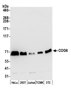 COG6 Polyclonal Antibody, Bethyl Laboratories 20 &mu;L | Buy Online | Bethyl Laboratories, Inc | Fisher Scientific