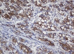 COG6 Mouse anti-Human, Clone: OTI4G4, lyophilized, TrueMAB 100 &mu;g; Unconjugated:Antibodies,