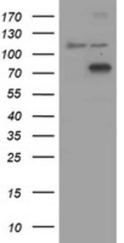 COG6 Mouse anti-Human, Clone: OTI4G4, lyophilized, TrueMAB 100 &mu;g; Unconjugated:Antibodies,