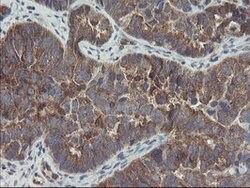 COMMD1 Mouse anti-Human, Clone: OTI3B3, lyophilized, TrueMAB 100 &mu;g;