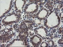 COMMD1 Mouse anti-Human, Clone: OTI3B3, lyophilized, TrueMAB 100 &mu;g;