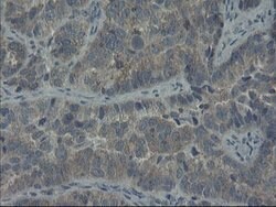 COMMD1 Mouse anti-Human, Clone: OTI1C3, lyophilized, TrueMAB 100 &mu;g;