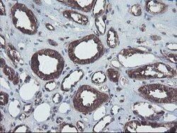 COMMD1 Mouse anti-Canine, Human, Mouse, Rat, Clone: OTI1F2, lyophilized,