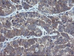 COMMD1 Mouse anti-Canine, Human, Rat, Clone: OTI2D10, lyophilized, TrueMAB
