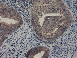 COMMD1 Mouse anti-Human, Clone: OTI1G7, lyophilized, TrueMAB 100 &mu;g;