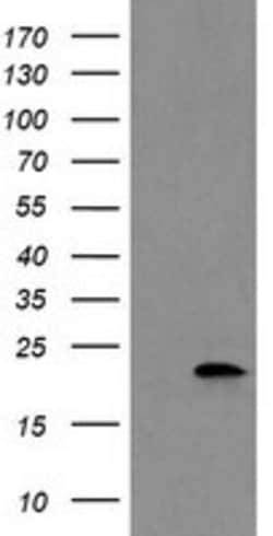 COMMD1 Mouse anti-Human, Clone: OTI3B3, lyophilized, TrueMAB 100 &mu;g;