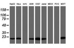 COMMD1 Mouse anti-Human, Clone: OTI3B3, lyophilized, TrueMAB 100 &mu;g;