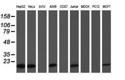 COMMD1 Mouse anti-Human, Clone: OTI1C3, lyophilized, TrueMAB 100 &mu;g;