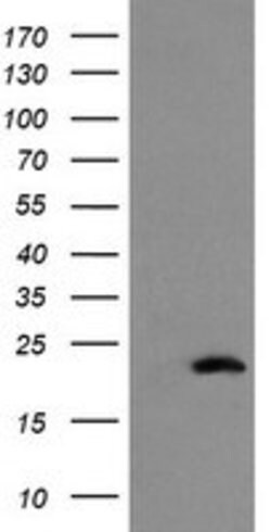 COMMD1 Mouse anti-Canine, Human, Mouse, Rat, Clone: OTI1F2, lyophilized,