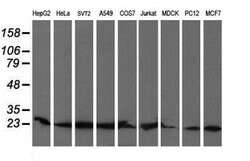 COMMD1 Mouse anti-Canine, Human, Mouse, Rat, Clone: OTI1F2, lyophilized,