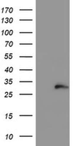 COMMD1 Monoclonal Antibody (OTI2D10), TrueMAB , OriGene 30 &mu;L; Unconjugated:Antibodies,