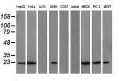 COMMD1 Mouse anti-Canine, Human, Rat, Clone: OTI2D10, lyophilized, TrueMAB