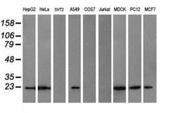 COMMD1 Monoclonal Antibody (OTI2D10), TrueMAB , OriGene 30 &mu;L; Unconjugated:Antibodies,