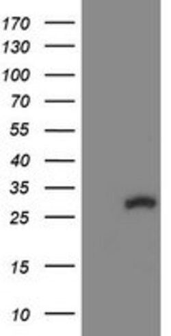 COMMD1 Mouse anti-Human, Clone: OTI1G7, lyophilized, TrueMAB 100 &mu;g;