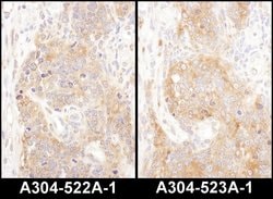 COPB2 Rabbit anti-Human, Mouse, Polyclonal, Bethyl Laboratories 100 &mu;L;