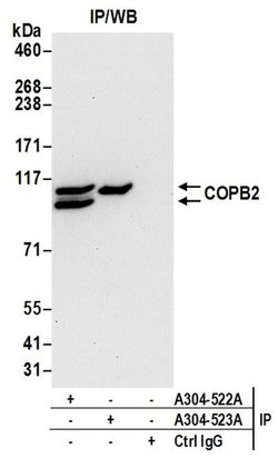 COPB2 Rabbit anti-Human, Mouse, Polyclonal, Bethyl Laboratories 100 &mu;L;