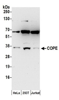 COPE Rabbit anti-Human, Polyclonal, Bethyl Laboratories 100 &mu;L | Buy Online | Bethyl Laboratories, Inc | Fisher Scientific