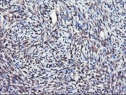 COPS5 Monoclonal Antibody (OTI2B12), TrueMAB , OriGene 30 &mu;L; Unconjugated:Antibodies,
