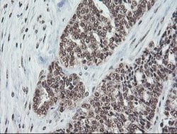 COPS5 Monoclonal Antibody (OTI2B12), TrueMAB , OriGene:Antibodies:Primary