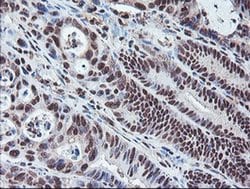 COPS5 Monoclonal Antibody (OTI2B12), TrueMAB , OriGene:Antibodies:Primary