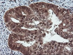 COPS5 Monoclonal Antibody (OTI2B12), TrueMAB , OriGene 30 &mu;L; Unconjugated:Antibodies,