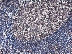 COPS5 Monoclonal Antibody (OTI2B12), TrueMAB , OriGene 30 &mu;L; Unconjugated:Antibodies,
