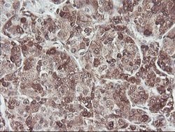 COPS5 Monoclonal Antibody (OTI2B12), TrueMAB , OriGene 30 &mu;L; Unconjugated:Antibodies,