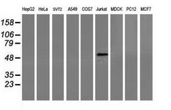 CORO1A Mouse anti-Human, Clone: OTI1A5, lyophilized, TrueMAB 100 &mu;g;