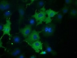 CORO1B Mouse anti-Human, Clone: OTI3D10, lyophilized, TrueMAB 100 &mu;g;