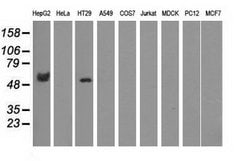 CORO1B Mouse anti-Human, Clone: OTI3D10, lyophilized, TrueMAB 100 &mu;g;